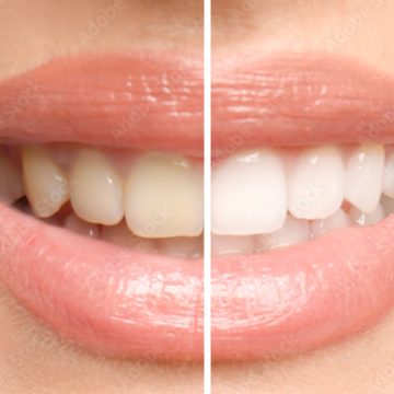 AdobeStock_225384784_Preview
